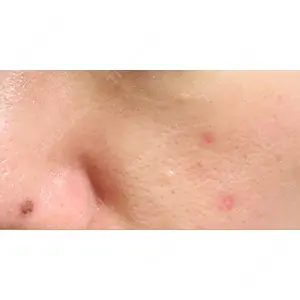 Fellez Clinic【フェルズクリニック】口コミ