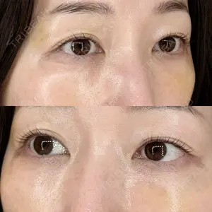 セオリークリニック口コミ