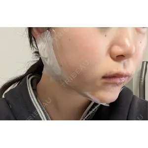 ビラビューティークリニック 博多美容外科/美容皮膚科 ビラビューティークリニック口コミ