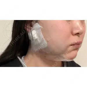 ビラビューティークリニック 博多美容外科/美容皮膚科 ビラビューティークリニック口コミ