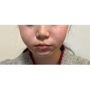 ビラビューティークリニック 博多美容外科/美容皮膚科 ビラビューティークリニック口コミ