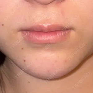 栄美容クリニックの口コミ