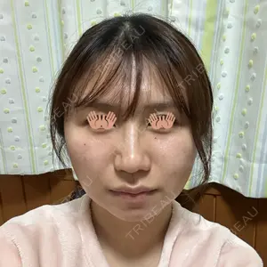 口コミ