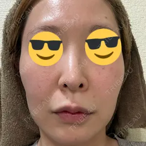 東京シルククリニック 東京シルククリニック 新宿院口コミ