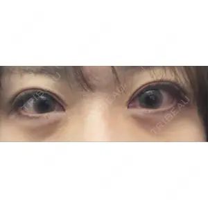 プロクリニック PRO CLINIC プロクリニック 銀座院口コミ