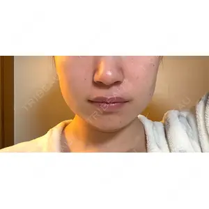 ルラ美容クリニック ルラ美容クリニック 大阪本院口コミ