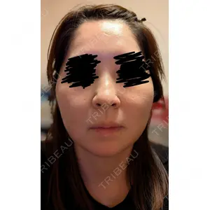 ルラ美容クリニック ルラ美容クリニック 郡山院口コミ