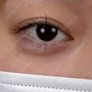 AI Beauty Clinic （エーアイ美容クリニック）口コミ