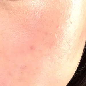 心斎橋なんばRINBEAUTYCLINIC美容皮膚科美容外科 RIN BEAUTY CLINIC口コミ