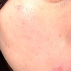 心斎橋なんばRINBEAUTYCLINIC美容皮膚科美容外科 RIN BEAUTY CLINIC口コミ