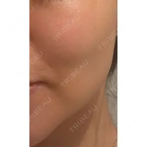 東京シルククリニック 東京シルククリニック 新宿院口コミ