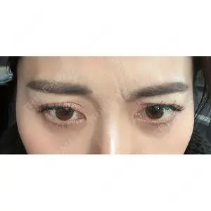 Belle Via Skin Clinic Belle Via Clinic口コミ