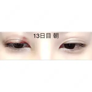 口コミ