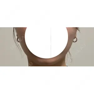 Nebula Clinic 小倉美容外科ネビュラクリニック口コミ