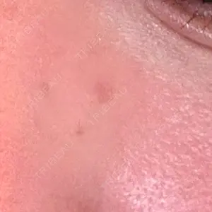 心斎橋KT美容クリニック口コミ