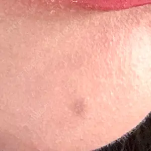 心斎橋KT美容クリニック口コミ