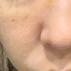 銀座TMクリニック口コミ