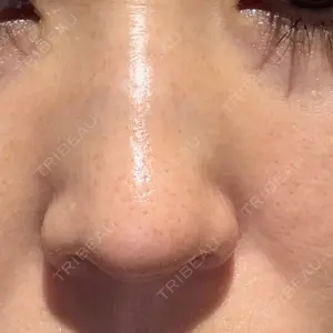 銀座TMクリニック口コミ