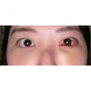 韓国ST美容整形外科口コミ