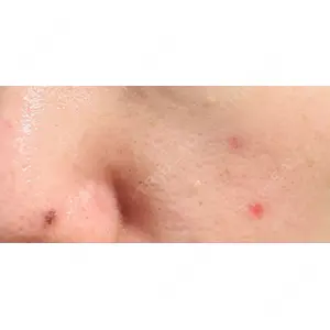 Fellez Clinic【フェルズクリニック】口コミ
