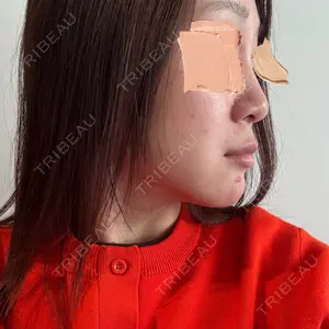 APスキンクリニック銀座口コミ