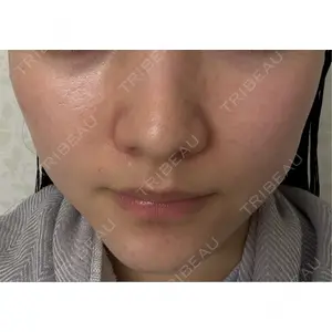 Belle Via Skin Clinic Belle Via Clinic口コミ