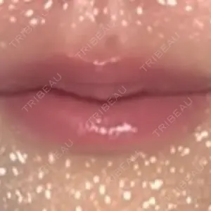 ルラ美容クリニック ルラ美容クリニック 大阪本院口コミ