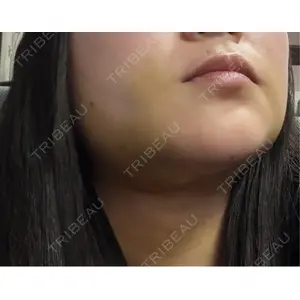 ビラビューティークリニック 博多美容外科/美容皮膚科 ビラビューティークリニック口コミ