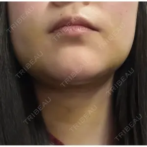 ビラビューティークリニック 博多美容外科/美容皮膚科 ビラビューティークリニック口コミ