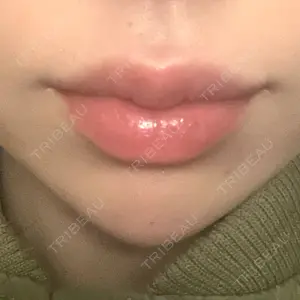 L‘amour clinic Tokyo【ラムールクリニック東京】口コミ