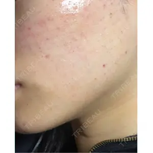 ルラ美容クリニック ルラ美容クリニック 広島院口コミ