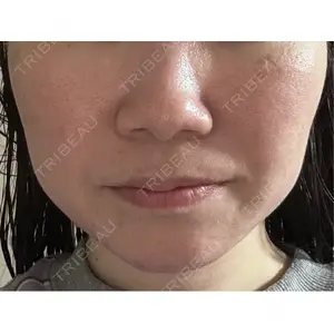 NEO Skin Clinic NEO Skin Clinic恵比寿口コミ