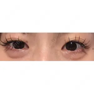 プロクリニック PRO CLINIC プロクリニック 銀座院口コミ