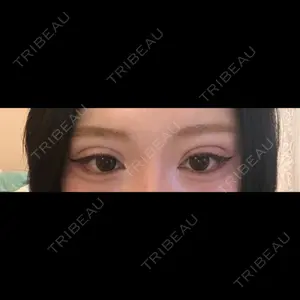 口コミ