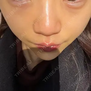 口コミ