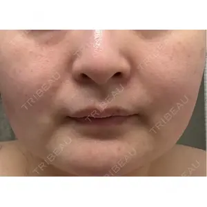 ルラ美容クリニック ルラ美容クリニック 郡山院口コミ