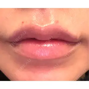 ルラ美容クリニック ルラ美容クリニック 大阪本院口コミ