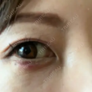 アネシス美容クリニック口コミ