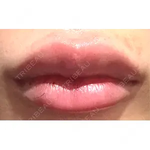 L‘amour clinic Tokyo【ラムールクリニック東京】口コミ