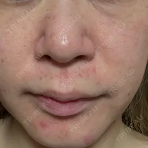 東京シルククリニック 東京シルククリニック 新宿院口コミ