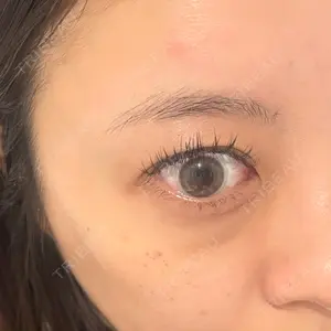 東京シルククリニック 東京シルククリニック 新宿院口コミ