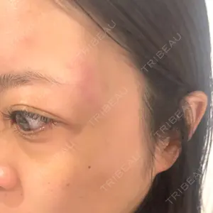 東京シルククリニック 東京シルククリニック 新宿院口コミ