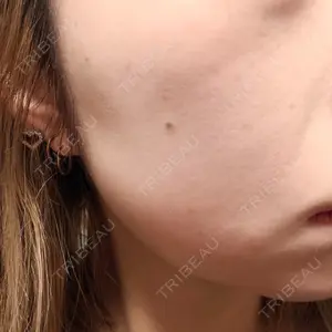 ビラビューティークリニック 博多美容外科/美容皮膚科 ビラビューティークリニック口コミ