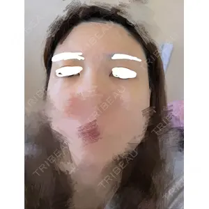 PRISM Beauty Clinic  PRISM Beauty Clinic 新宿院口コミ