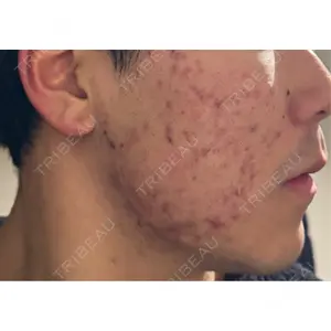 ルラ美容クリニック ルラ美容クリニック 広島院口コミ