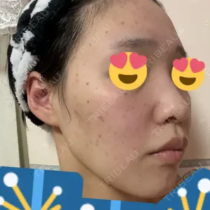 ルラ美容クリニック ルラ美容クリニック 札幌本院口コミ