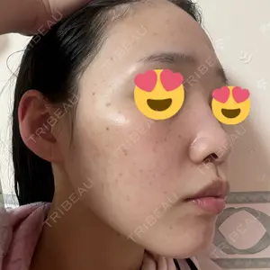 ルラ美容クリニック ルラ美容クリニック 札幌本院口コミ