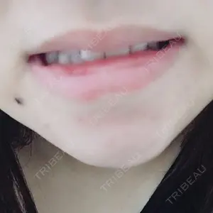 RG整形外科（旧リオン整形外科）口コミ