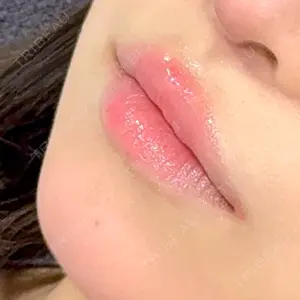 口コミ