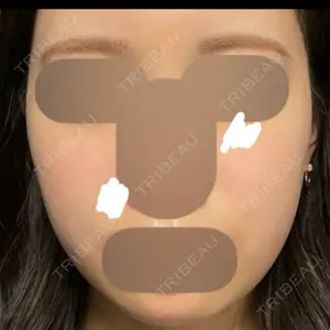 BBC BBC表参道院口コミ